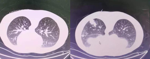 精准诊疗是我们追求的目标1.jpg