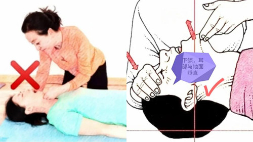 溺水后首先控水对吗4.jpg