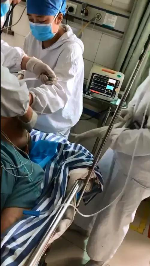 心脏骤停致58岁男士突然昏迷3.jpg