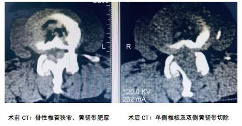 多年走路双腿像灌铅2.jpg
