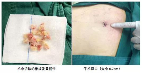 多年走路双腿像灌铅1.jpg