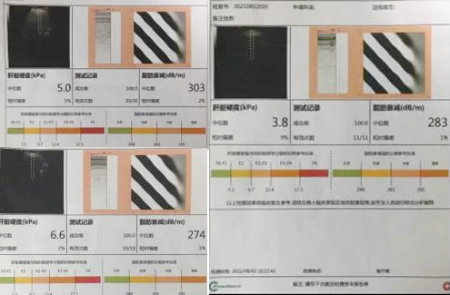 55岁女士头晕乏力全身不适1.jpg