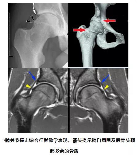 运动健身要当心1.jpg