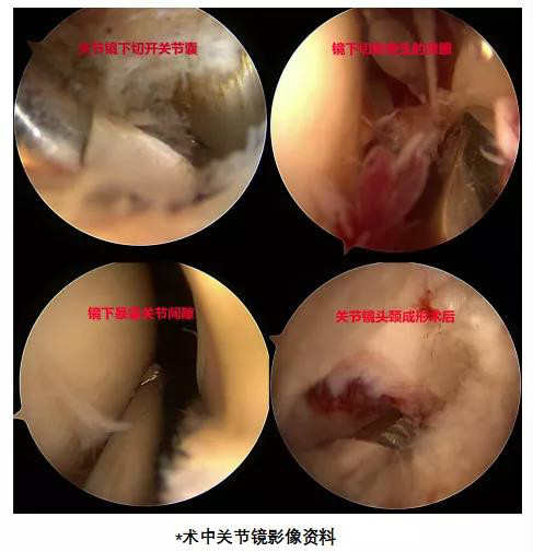 运动健身要当心3.jpg