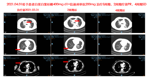 病情凶险永不言弃1.png