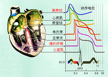 胸闷憋气15年加重3天78岁老人确诊心动过速电生理检查射频消融造影icd