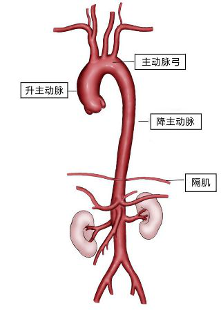 胸闷憋喘伴胸背疼痛3年老毛病突然加重65岁主动脉夹层患者转诊来济南