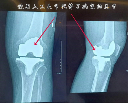 微信图片_20221114153002.png