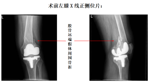 微信图片_20221124085606.png