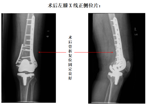 微信图片_20221124085614.png