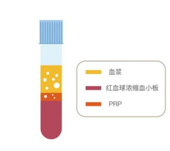 膝关节病变六旬老人半年难行走5.png