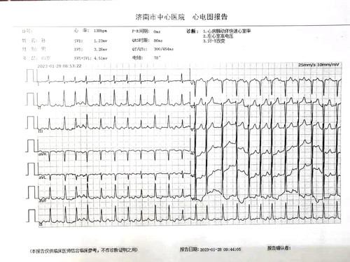 参加早诊早治项目意外发现房颤2.jpg